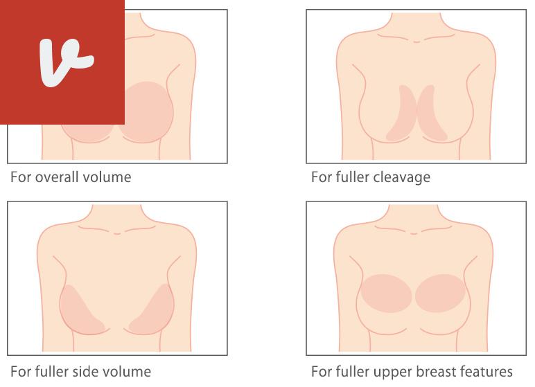 breast enhancement injections