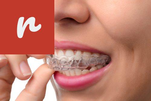 How Clear Teeth Retainers Can Help Maintain Your Dental Health