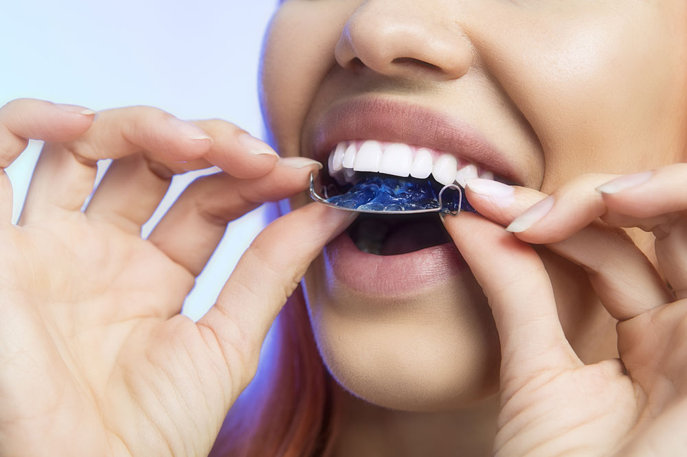 3. Pros and Cons of Retainer Fees for Professional Services