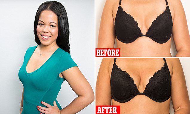 3. Why Women are Turning to the Breast Lift Vampire Procedure